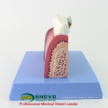 DENTAL35(12625-1) Large Size Dental Implant Didactic Medical Anatomy Models